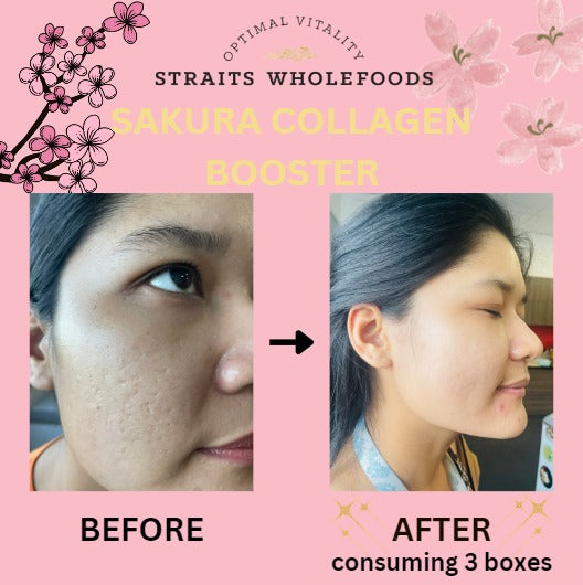 PREMIUM SAKURA COLLAGEN BOOSTER (Plant-based)