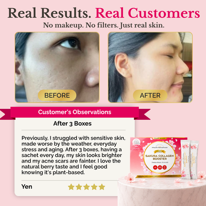 PREMIUM SAKURA COLLAGEN BOOSTER